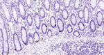 Chromogranin A Antibody in Immunohistochemistry (Paraffin) (IHC (P))