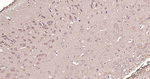 TBK1 Antibody in Immunohistochemistry (Paraffin) (IHC (P))