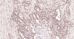 TBK1 Recombinant Rabbit Monoclonal Antibody (B5H9)