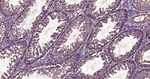 TBK1 Antibody in Immunohistochemistry (Paraffin) (IHC (P))