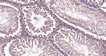 TBK1 Antibody in Immunohistochemistry (Paraffin) (IHC (P))