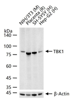 TBK1 Antibody in Western Blot (WB)
