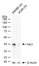 PAI1 Antibody in Western Blot (WB)