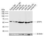 STIP1 Antibody in Western Blot (WB)