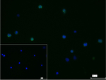 CD206 Recombinant Rabbit Monoclonal Antibody (12A3)