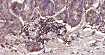 CD206 Antibody in Immunohistochemistry (Paraffin) (IHC (P))