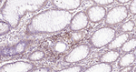 CD206 Antibody in Immunohistochemistry (Paraffin) (IHC (P))