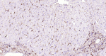 CD206 Antibody in Immunohistochemistry (Paraffin) (IHC (P))