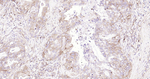 CD206 Antibody in Immunohistochemistry (Paraffin) (IHC (P))