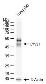 LYVE1 Recombinant Rabbit Monoclonal Antibody (C12B6)