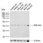 IkB beta Recombinant Rabbit Monoclonal Antibody (18E7)