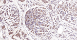 BAX Antibody in Immunohistochemistry (Paraffin) (IHC (P))