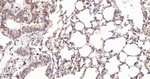 BAX Antibody in Immunohistochemistry (Paraffin) (IHC (P))