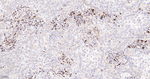 BAX Antibody in Immunohistochemistry (Paraffin) (IHC (P))