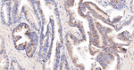 BAX Antibody in Immunohistochemistry (Paraffin) (IHC (P))