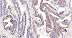 BAX Antibody in Immunohistochemistry (Paraffin) (IHC (P))