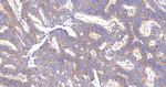 BAX Antibody in Immunohistochemistry (Paraffin) (IHC (P))