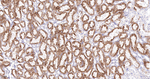 BAX Antibody in Immunohistochemistry (Paraffin) (IHC (P))