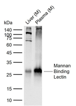 MBL2 Recombinant Rabbit Monoclonal Antibody (18B9)