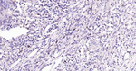 Granzyme B Antibody in Immunohistochemistry (Paraffin) (IHC (P))