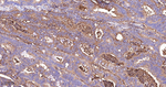 SERPINA3 Antibody in Immunohistochemistry (Paraffin) (IHC (P))