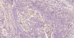 SERPINA3 Antibody in Immunohistochemistry (Paraffin) (IHC (P))