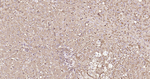 SERPINA3 Antibody in Immunohistochemistry (Paraffin) (IHC (P))