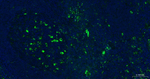 SERPINA3 Recombinant Rabbit Monoclonal Antibody (A12D5)