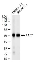 SERPINA3 Antibody in Western Blot (WB)