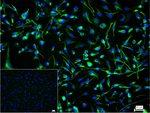 Nestin Recombinant Rabbit Monoclonal Antibody (B5H6)