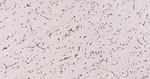 Nestin Antibody in Immunohistochemistry (Paraffin) (IHC (P))