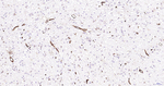 Nestin Antibody in Immunohistochemistry (Paraffin) (IHC (P))