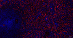 Nestin Antibody in Immunohistochemistry (Paraffin) (IHC (P))