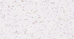 Nestin Antibody in Immunohistochemistry (Paraffin) (IHC (P))