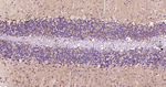 NSE Recombinant Rabbit Monoclonal Antibody (H12A5)