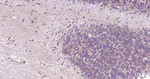 NSE Antibody in Immunohistochemistry (Paraffin) (IHC (P))
