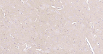 NSE Antibody in Immunohistochemistry (Paraffin) (IHC (P))