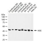 NSE Antibody in Western Blot (WB)