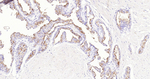PSMA Recombinant Rabbit Monoclonal Antibody (B11A8)