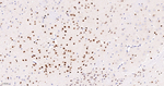 SOX2 Antibody in Immunohistochemistry (Paraffin) (IHC (P))