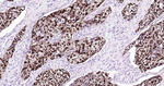 SOX2 Antibody in Immunohistochemistry (Paraffin) (IHC (P))