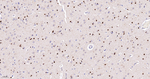 SOX2 Antibody in Immunohistochemistry (Paraffin) (IHC (P))