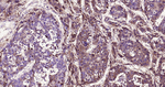 AFP Antibody in Immunohistochemistry (Paraffin) (IHC (P))