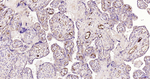 AFP Antibody in Immunohistochemistry (Paraffin) (IHC (P))