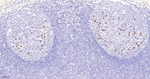 CD57 Antibody in Immunohistochemistry (Paraffin) (IHC (P))