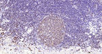 CD79a Recombinant Rabbit Monoclonal Antibody (A7D11)