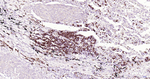 CD79a Antibody in Immunohistochemistry (Paraffin) (IHC (P))