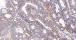 CD99 Recombinant Rabbit Monoclonal Antibody (D6E10)