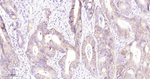 c-Met Antibody in Immunohistochemistry (Paraffin) (IHC (P))