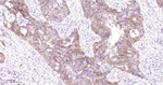 c-Met Recombinant Rabbit Monoclonal Antibody (E8D11)
